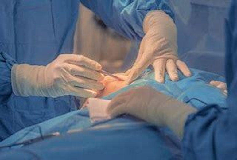 Dermatologie diagnostische excisie